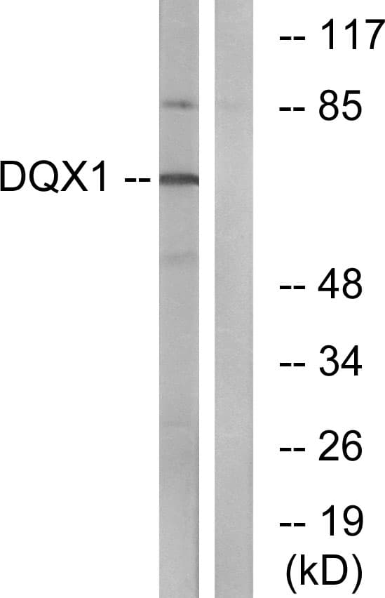 IHC-plus™ DQX1 Antibody (aa551-600)