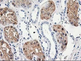 ACY1 / Aminoacylase 1 Antibody (clone OTI1B12)