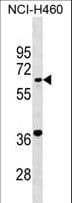 GATB / PET112 Antibody (aa34-61)