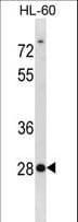 SDCBP2 / Syntenin 2 Antibody (aa98-127)