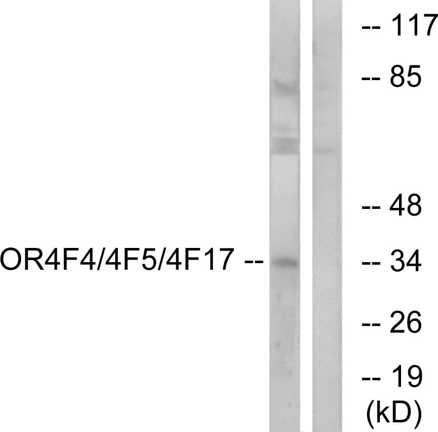 OR4F4+5+17 Antibody (aa51-100)