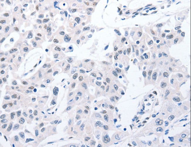 POMC / Proopiomelanocortin Antibody