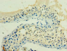 Polyclonal Rabbit anti-Human HSPA2 Antibody (aa400-639, IHC, WB)