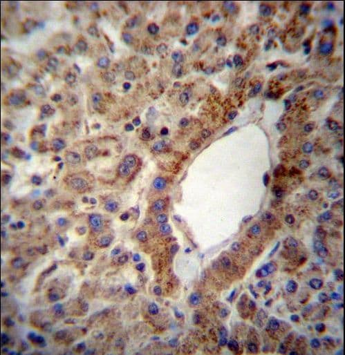 IHC-plus™ Polyclonal Rabbit anti-Human ACSS2 / ACAS2 Antibody (aa261-290, IHC, WB)
