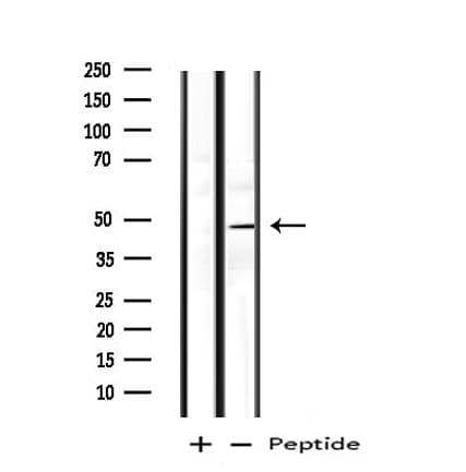 BAG4 / SODD Antibody