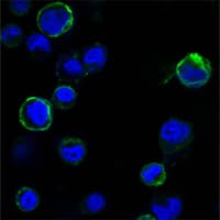 ROR1 Antibody (clone 2H6)