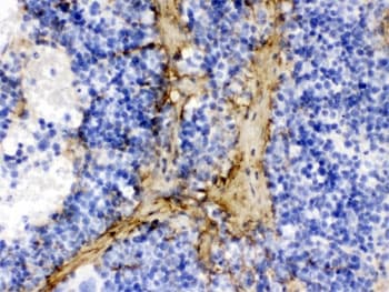 Polyclonal Rabbit anti-Mouse COL1A1 / Collagen I Alpha 1 Antibody (IHC, WB)
