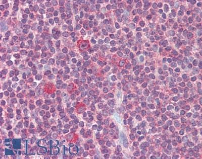 IHC-plus™ GART / GARS Antibody (aa960-1010)