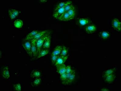 Polyclonal Rabbit anti-Human ALDH5A1 Antibody (aa48-535)