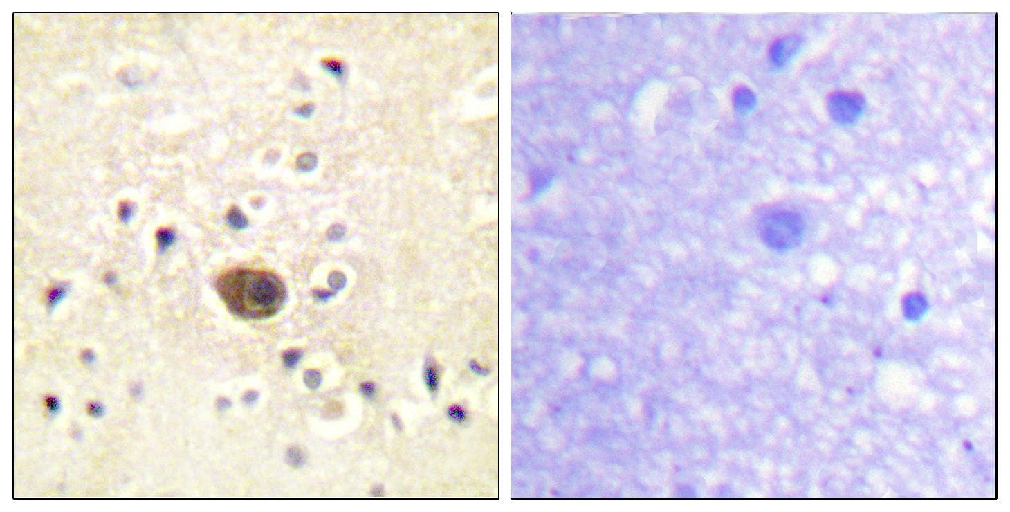 Polyclonal Rabbit anti-Human RASGRF1 / CDC25 Antibody (Ab-916, IHC)