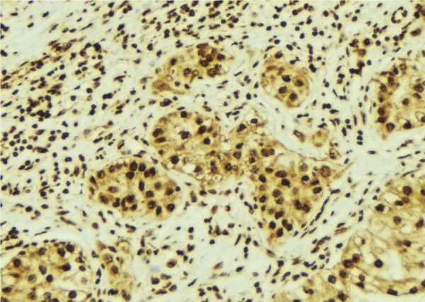 KPNA2 / Importin Alpha 1 Antibody