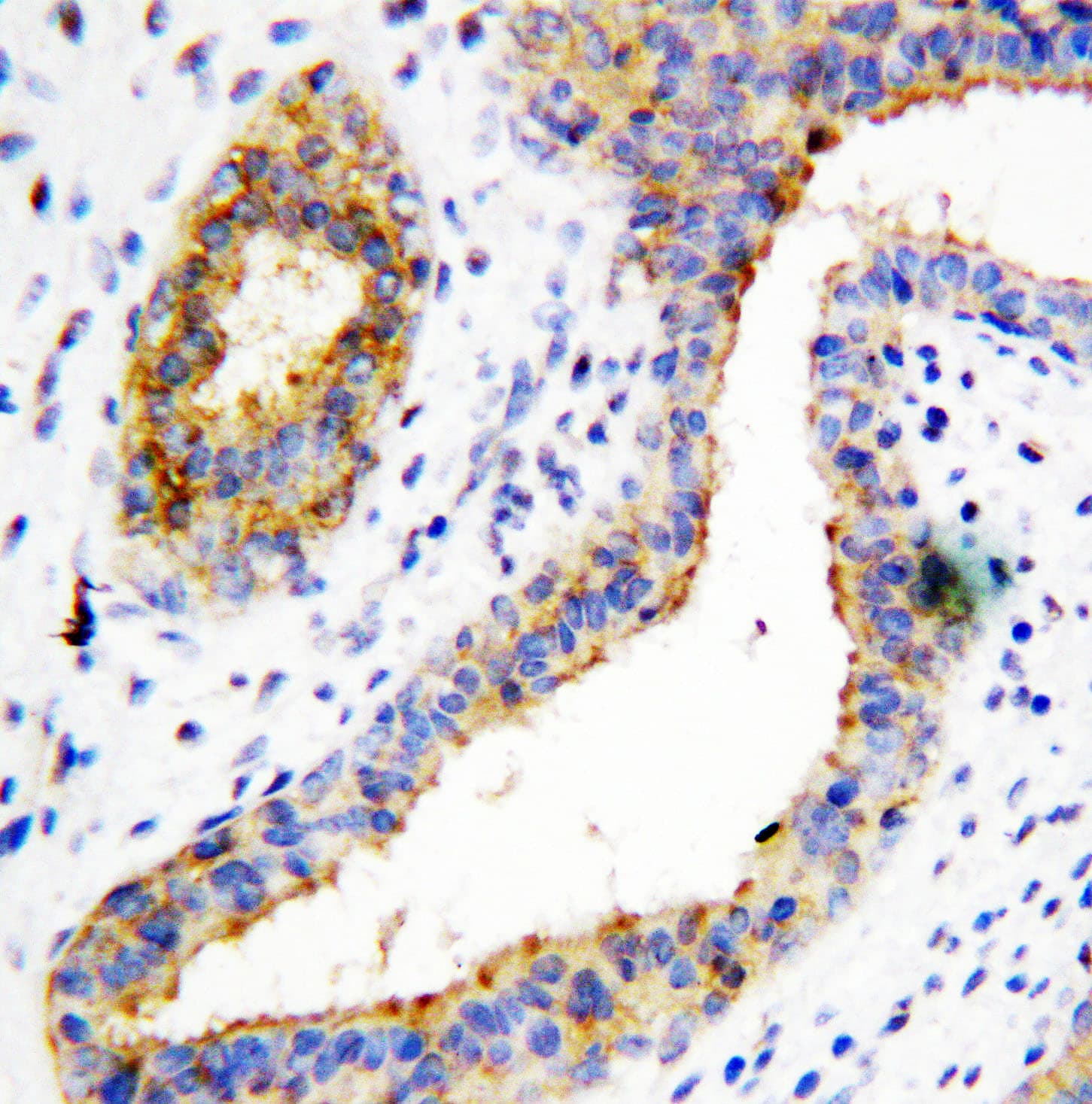 BCAT1 / ECA39 Antibody (aa360-375)