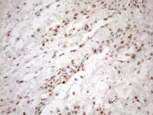 MGMT Antibody (clone OTI10H9)