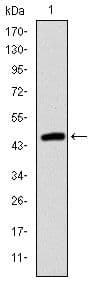 TNNI2 Antibody (clone 2F12A11)