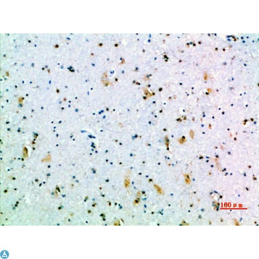 GH / Growth Hormone Antibody
