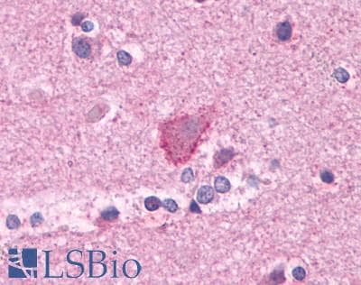 PathPlus™ GRM3 / MGLUR3 Antibody (N-Terminus)