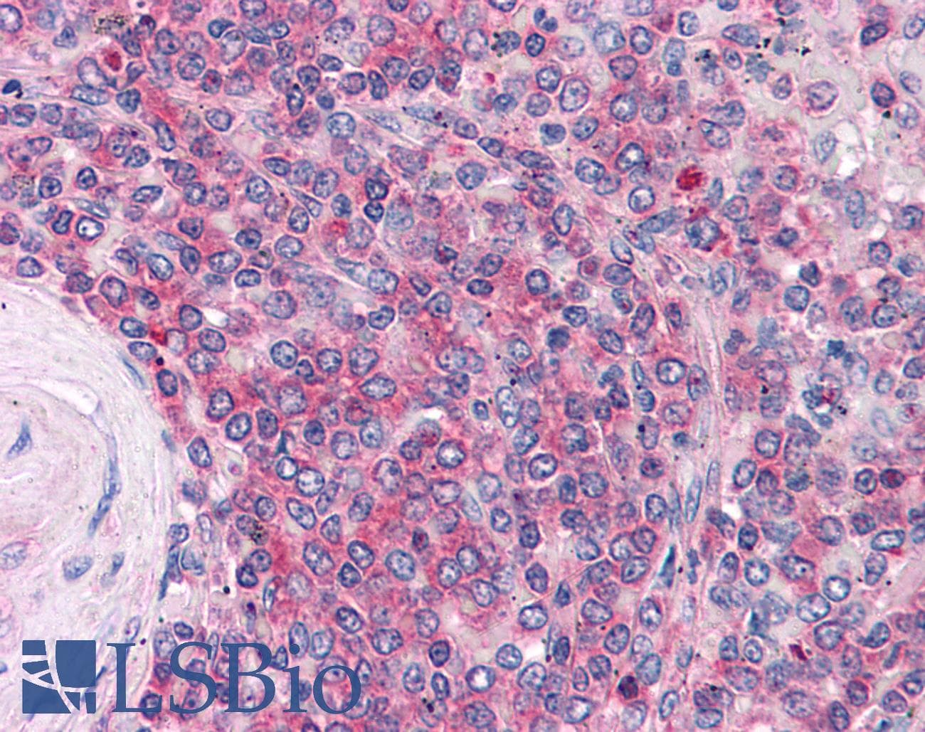 PathPlus™ PDGFRA / PDGFR Alpha Antibody