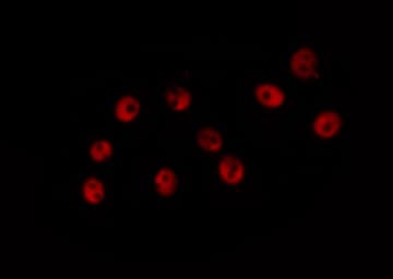 CHEK2 / CHK2 Antibody (phospho-Thr387)