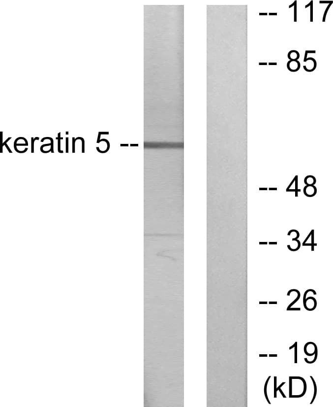 PathPlus™ KRT5 / CK5 / Cytokeratin 5 Antibody (aa541-590)