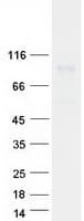 Human PLOD / PLOD1 Protein (Recombinant Myc-DDK (Flag))