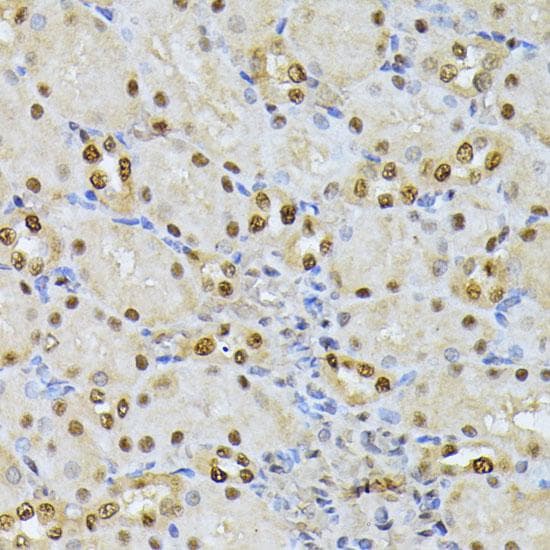 Polyclonal Rabbit anti-Human RPS27A Antibody (IHC)
