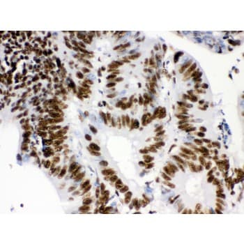 RBBP4 / RBAP48 Antibody (aa395-425)