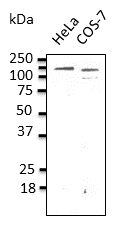 IHC-plus™ Polyclonal Goat anti-Human CDH1 / E Cadherin Antibody (IHC, WB)