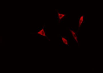 CALD1 / Caldesmon Antibody (phospho-Ser789)