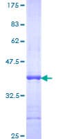 Human ARL8 / ARL5B Protein (Recombinant GST, N-terminus)