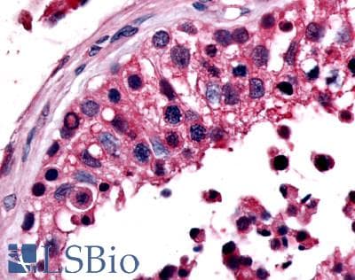 PathPlus™ ESRRB / ERR Beta Antibody (Ligand-binding Domain)