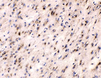 Polyclonal Rabbit anti-Human TUBB3 / Tubulin Beta 3 Antibody (IHC, WB)