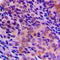 RRAGA+B Antibody (C-Terminus)