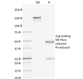 AMACR / P504S Antibody (clone AMACR/1864, Ready-to-Use)