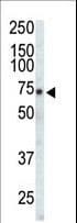 EPHA3 / EPH Receptor A3 Antibody (aa896-928)