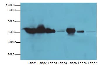 GAPDH Antibody
