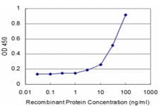 IHC-plus™ CTSK / Cathepsin K Antibody (clone 2F1)
