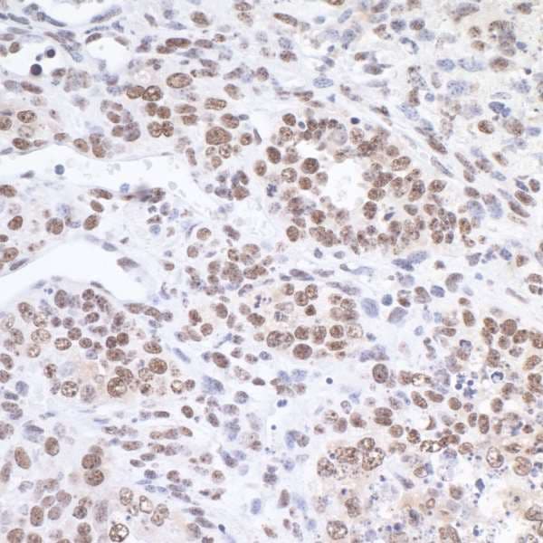 Polyclonal Rabbit anti-Human FUS / TLS Antibody (aa400-450, IHC, WB)