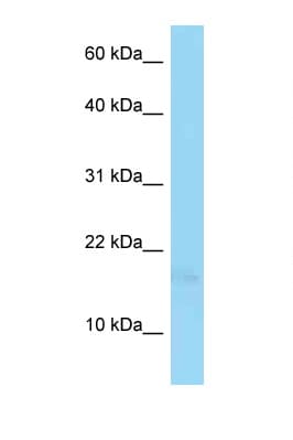Polyclonal Rabbit anti-Human PSORS1C1 Antibody (N-Terminus, WB)