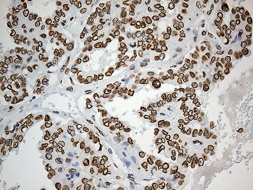 SLU7 / 9G8 Antibody (aa1-300, clone OTI5A7, Carrier-free)