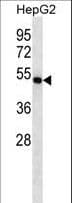 Polyclonal Rabbit anti-Human FDFT1 / Squalene Synthase Antibody (aa332-361, WB)