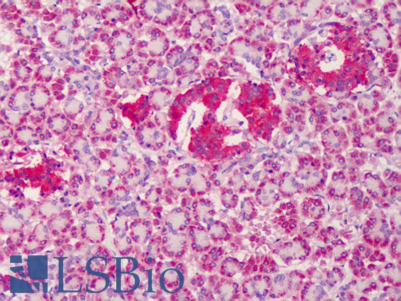 IHC-plus™ Polyclonal Rabbit anti-Human CD82 Antibody (IHC, IF, WB)