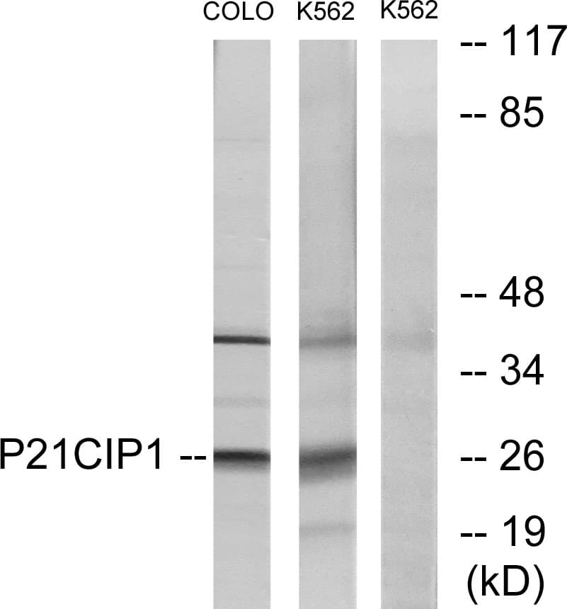 IHC-plus™ CDKN1A / WAF1 / p21 Antibody (aa111-160)