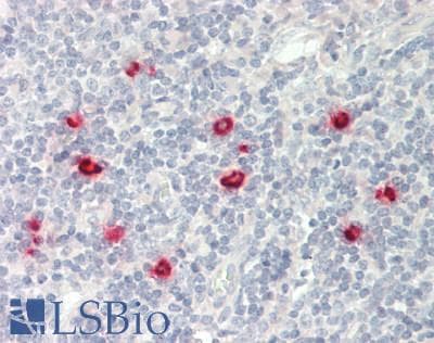 PathPlus™ CMA1 / Mast Cell Chymase Antibody (aa164-213)