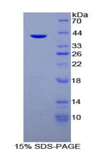 Human MUC6 / MUC-6 Protein (Recombinant His-GST)