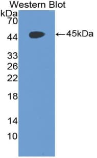 ADGRE5 / CD97 Antibody (aa191-304)