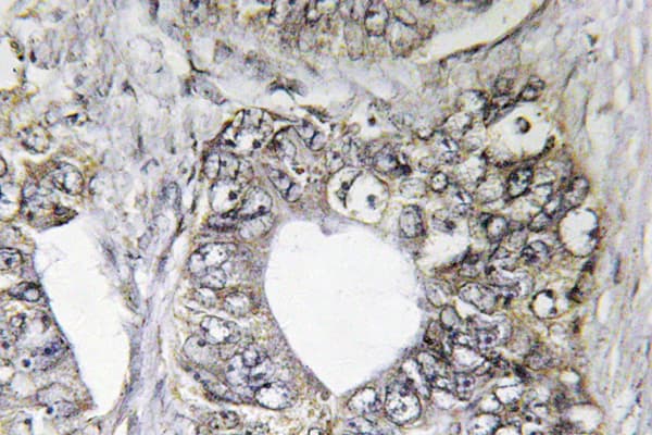 JNK1+2+3 Antibody (Thr178)