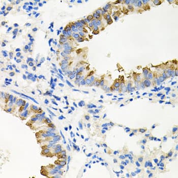 IRAK2 / IRAK-2 Antibody