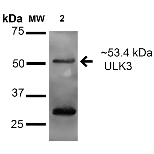 ULK3 Antibody