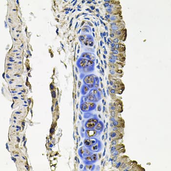 FLT1 / VEGFR1 Antibody