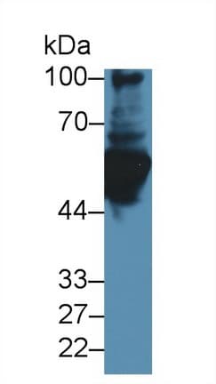 GFAP Antibody (aa70-374, FITC)
